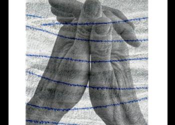 Wound Assolution (1)